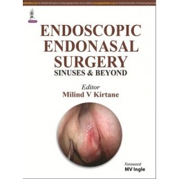 Endoscopic Endonasal Surgery: Sinuses and Beyond