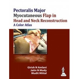 Pectoralis Major Myocutaneous Flap in Head and Neck Reconstruction: A Color Atlas