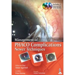 Management of Phaco Complications: Newer Techniques