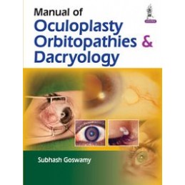 Manual of Oculoplasty,...