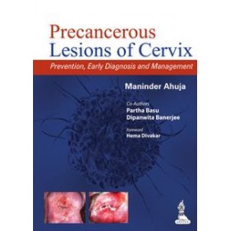 Precancerous Lesions of...