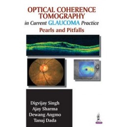 Optical Coherence...