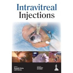 Intravitreal Injections