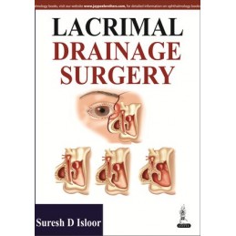 Lacrimal Drainage Surgery