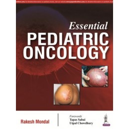 Essential Pediatric Oncology