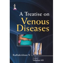 A Treatise on Venous Diseases