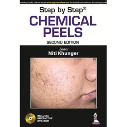 Step by Step: Chemical Peels