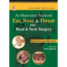 An Illustrated Textbook: Ear, Nose & Throat and Head & Neck Surgery