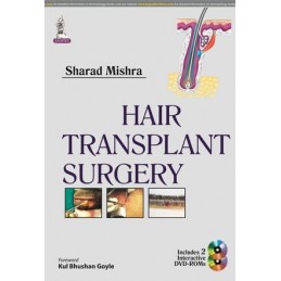 Hair Transplant Surgery