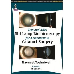 Text and Atlas: Slit Lamp Biomicroscopy for Assessment in Cataract Surgery