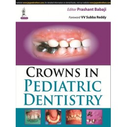 Crowns in Pediatric Dentistry