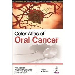 Color Atlas of Oral Cancer