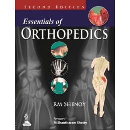 Essentials of Orthopedics