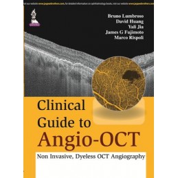 Clinical Guide to Angio-OCT: Non Invasive, Dyeless OCT Angiography