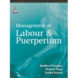 Management of Labour & Puerperium