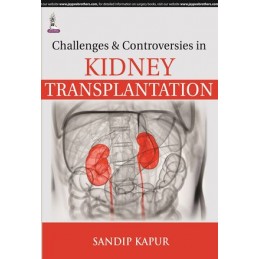 Challenges and Controversies in Kidney Transplantation