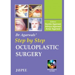 Dr. Agarwal's Step by Step Oculoplastic Surgery
