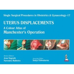 Single Surgical Procedures in Obstetrics and Gynaecology - 17 - UTERUS DISPLACEMENTS: A Colour Atlas of Manchester's Operation