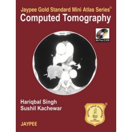 Jaypee Gold Standard Mini Atlas Series of Computed Tomography