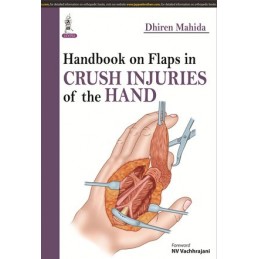 Handbook on Flaps in Crush...