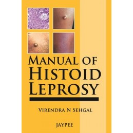 Manual of Histoid Leprosy