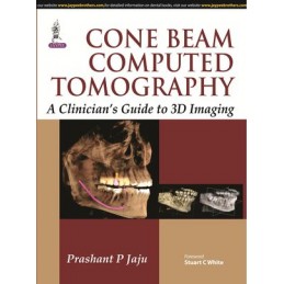 Cone Beam Computed Tomography