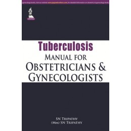 Tuberculosis Manual for...