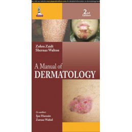 A Manual of Dermatology