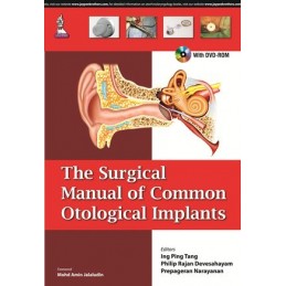 The Surgical Manual of Common Otological Implants