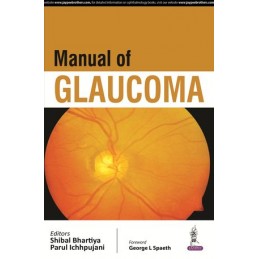 Manual of Glaucoma