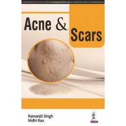 Acne & Scars