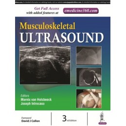 Musculoskeletal Ultrasound