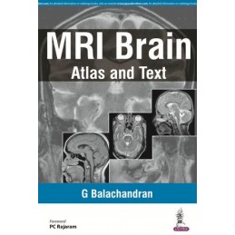 MRI Brain: Atlas and Text