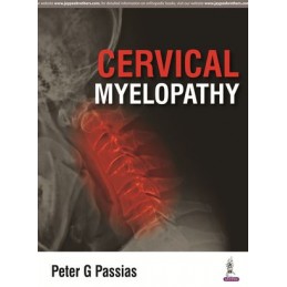 Cervical Myelopathy