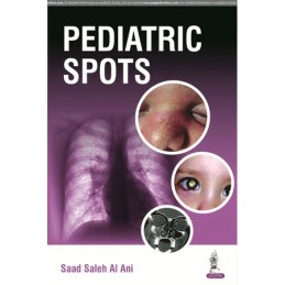 Pediatric Spots