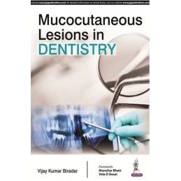 Mucocutaneous Lesions in...