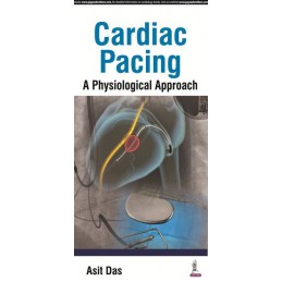 Cardiac Pacing A...