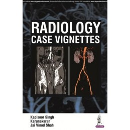 Radiology Case Vignettes