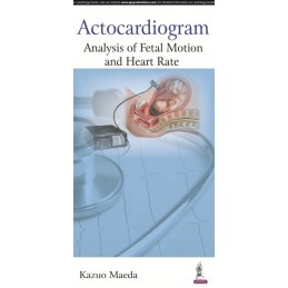 Actocardiogram: Analysis of...