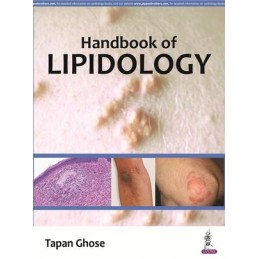 Handbook of Lipidology