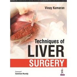 Techniques of Liver Surgery