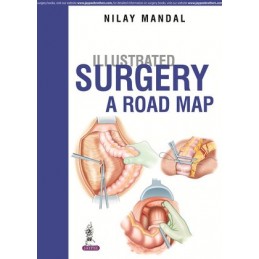 Illustrated Surgery - A...