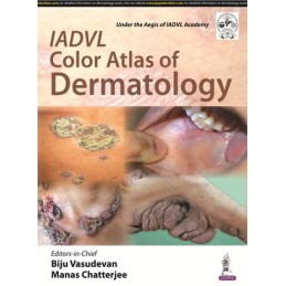IADVL Color Atlas of...