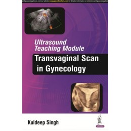 Ultrasound Teaching Module: Transvaginal Scan in Gynecology
