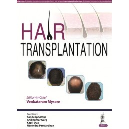 Hair Transplantation