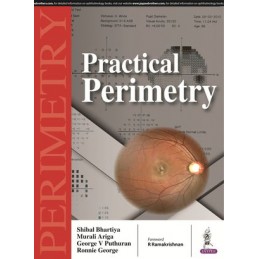 Practical Perimetry