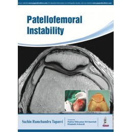 Patellofemoral Instability