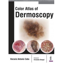 Color Atlas of Dermoscopy