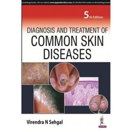 Diagnosis and Treatment of...