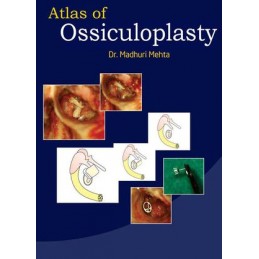 Atlas of Ossiculoplasty